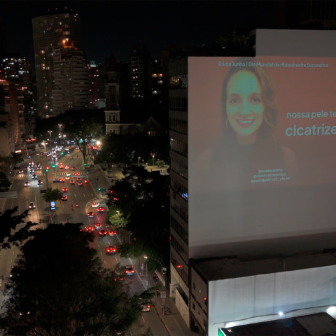 Com apoio de associações gaúchas, pacientes projetam manifesto em São Paulo para romper silêncio sobre a hidradenite supurativa